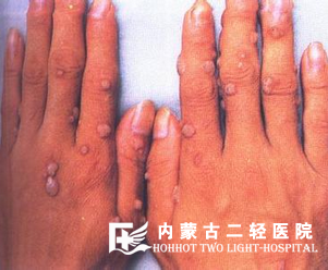 皮肤红肿痒是怎么回事